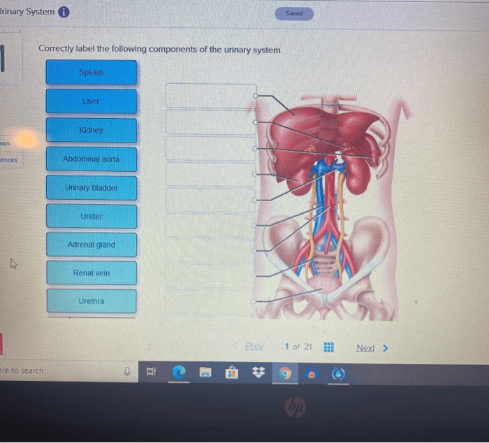 Correctly label the components of the urinary system